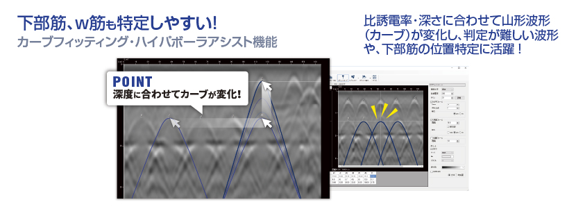 ハイパボーラアシスト機能