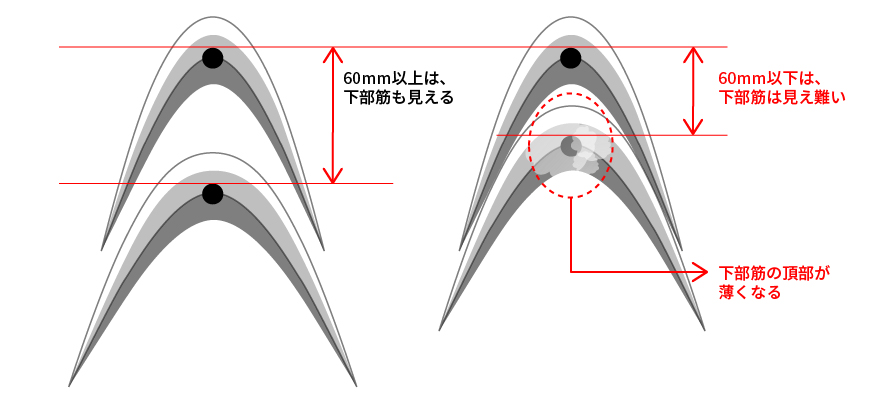 鉄筋探査 W筋